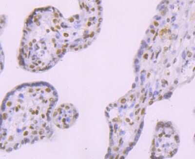 Immunohistochemistry-Paraffin: DNA Ligase IV Antibody (JM64-32) [NBP2-75474] - Analysis of paraffin-embedded human placenta tissue using anti-DNA Ligase IV antibody. Counter stained with hematoxylin.