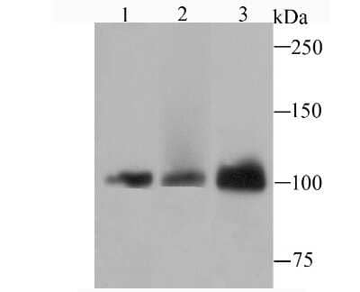Western Blot: DNA Ligase IV Antibody (JM64-32) [NBP2-75474] - Analysis of DNA Ligase IV on Hela cell using anti-DNA Ligase IV antibody at 1/1,000 dilution.Positive control:Lane 1: HepG2            Lane 2: HelaLane 3: Jurkat