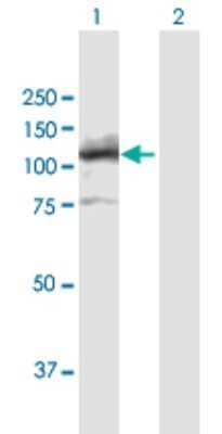 Western Blot: DNA Ligase IV Antibody [H00003981-B01P] - Analysis of LIG4 expression in transfected 293T cell line by LIG4 polyclonal antibody.  Lane 1: LIG4 transfected lysate(100.21 KDa). Lane 2: Non-transfected lysate.