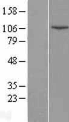 Western Blot: DNA Ligase IV Overexpression Lysate (Adult Normal) [NBP2-10924] Left-Empty vector transfected control cell lysate (HEK293 cell lysate); Right -Over-expression Lysate for DNA Ligase IV.