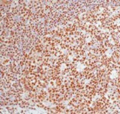 Immunohistochemistry-Paraffin: DNA-PKcs Antibody (18-2) [NB600-1203] - Human tonsil stained with DNA-PKcs using peroxidase-conjugate and AEC chromogen. Note nuclear staining of lymphocytes.