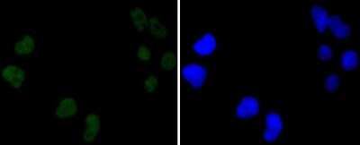 Immunocytochemistry/Immunofluorescence: DNA-PKcs Antibody (SC57-08) [NBP2-67554] - Staining DNA PKcs in Hela cells (green). The nuclear counter stain is DAPI (blue). Cells were fixed in paraformaldehyde, permeabilised with 0.25% Triton X100/PBS.