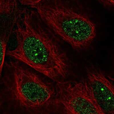 Immunocytochemistry/Immunofluorescence: DNA Polymerase Kappa Antibody [NBP2-56673] - Staining of human cell line U-2 OS shows localization to nucleoplasm & nuclear bodies. Antibody stainign is shown in green.