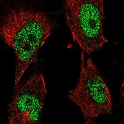 Immunocytochemistry/Immunofluorescence: DNA Polymerase Kappa Antibody [NBP2-57385] - Staining of human cell line U-251 MG shows localization to nucleoplasm.