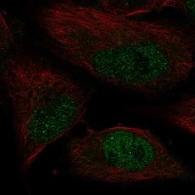 Immunocytochemistry/Immunofluorescence: DNA Polymerase Kappa Antibody [NBP2-57541] - Staining of human cell line U-251 MG shows localization to nucleoplasm.