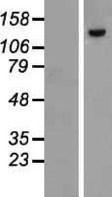 Western Blot: DNA Polymerase Kappa Overexpression Lysate (Adult Normal) [NBP2-07070] Left-Empty vector transfected control cell lysate (HEK293 cell lysate); Right -Over-expression Lysate for DNA Polymerase Kappa.