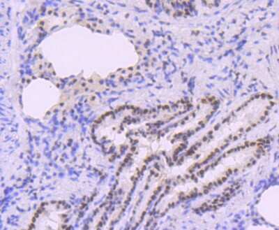 Immunohistochemistry-Paraffin: DNA Polymerase beta Antibody (JM93-12) [NBP2-67036] - Analysis of paraffin-embedded rat lung tissue using anti-DNA Polymerase beta antibody. Counter stained with hematoxylin.