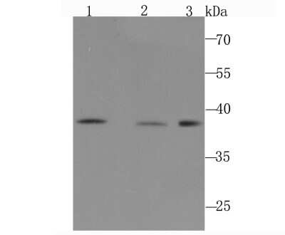Western Blot: DNA Polymerase beta Antibody (JM93-12) [NBP2-67036] - Analysis of DNA Polymerase beta on different cell lysates using anti-DNA Polymerase beta antibody at 1/1,000 dilution. Positive control:Lane 1: PC-12 Lane 2: NIH-3T3 Lane 3: A431