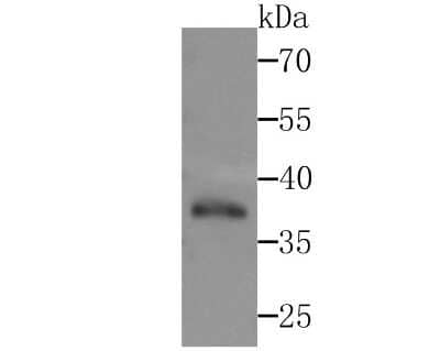 Western Blot: DNA Polymerase beta Antibody (JM93-12) [NBP2-67036] - Western blot analysis of DNA Polymerase beta on zebrafish tissue lysates. Proteins were transferred to a PVDF membrane and blocked with 5% BSA in PBS for 1 hour at room temperature. The primary antibody (1/500) was used in 5% BSA at room temperature for 2 hours. Goat Anti-Rabbit IgG - HRP Secondary Antibody (HA1001) at 1:200,000 dilution was used for 1 hour at room temperature.