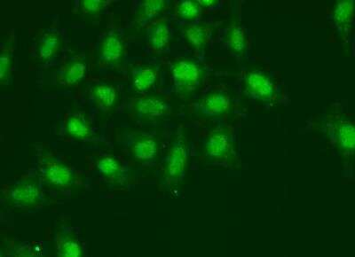 Immunocytochemistry/Immunofluorescence: DNA Polymerase delta, catalytic subunit Antibody [NBP2-92893] - Analysis of A549 cells using POLD1 antibody.