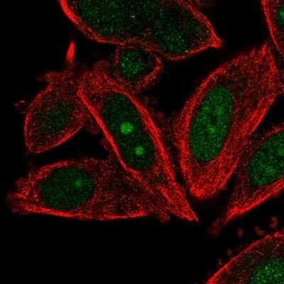 Immunocytochemistry/Immunofluorescence: DNA Polymerase epsilon subunit 3 Antibody [NBP2-13785] - Staining of human cell line PC-3 shows localization to nucleus & nucleoli.