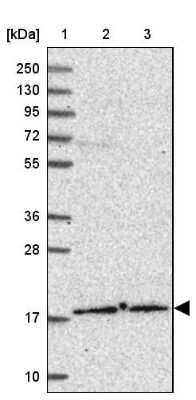 Western Blot: DNA Polymerase epsilon subunit 3 Antibody [NBP2-13785] - Lane 1: Marker  [kDa] 250, 130, 95, 72, 55, 36, 28, 17, 10.  Lane 2: Human cell line RT-4.  Lane 3: Human cell line U-251MG sp