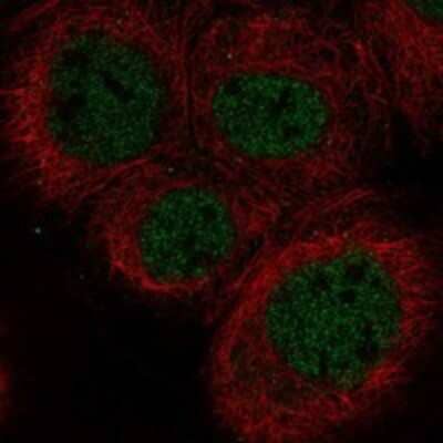 Immunocytochemistry/Immunofluorescence: DNA Polymerase lambda Antibody [NBP3-17833] - Staining of human cell line A-431 shows localization to nucleoplasm.