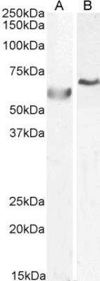 Western Blot: DNA Polymerase lambda Antibody [NB100-1358] - Staining of A549 (A) and HepG2 (B) cell lysate (35 ug protein in RIPA buffer). Primary incubation was 1 hour. Detected by chemiluminescence.