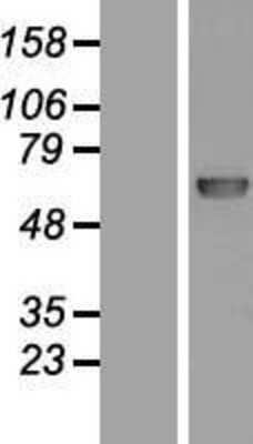 Western Blot: DNA Polymerase lambda Overexpression Lysate (Adult Normal) [NBL1-14573] Left-Empty vector transfected control cell lysate (HEK293 cell lysate); Right -Over-expression Lysate for DNA Polymerase lambda.