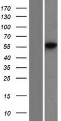 Western Blot: DNA Primase large subunit Overexpression Lysate (Adult Normal) [NBP2-10719] Left-Empty vector transfected control cell lysate (HEK293 cell lysate); Right -Over-expression Lysate for DNA Primase large subunit.