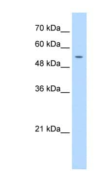 Western Blot: DNA Primase small subunit Antibody [NBP1-58184] - Titration: 1.25ug/ml Positive Control: K562 cell lysate.