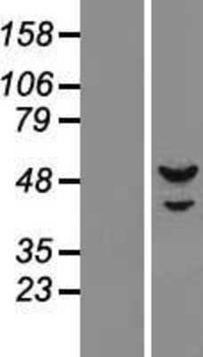 Western Blot: DNA Primase small subunit Overexpression Lysate (Adult Normal) [NBL1-14755] Left-Empty vector transfected control cell lysate (HEK293 cell lysate); Right -Over-expression Lysate for DNA Primase small subunit.