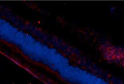 Immunocytochemistry/Immunofluorescence: DNA/RNA Damage Antibody (15A3) [NB110-96878] - visualized on a retinal injury