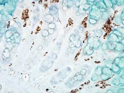 Immunohistochemistry: DNA/RNA Damage Antibody (15A3) [NB110-96878] - Immunohistochemistry analysis using Mouse Anti-DNA/RNA DamageMonoclonal Antibody, Clone 15A3 (NB110-96878). Tissue: inflamed colon. Species: Mouse. Fixation: Formalin. Primary Antibody: Mouse Anti-DNA/RNA DamageMonoclonal Antibody (NB110-96878) at 1:1000000 for 12 hours at 4C. Secondary Antibody: Biotin Goat Anti-Mouse at 1:2000 for 1 hour at RT. Counterstain: Mayer Hematoxylin (purple/blue) nuclear stain at 200 l for 2 minutes at RT. Magnification: 40x. With anti-microbial.