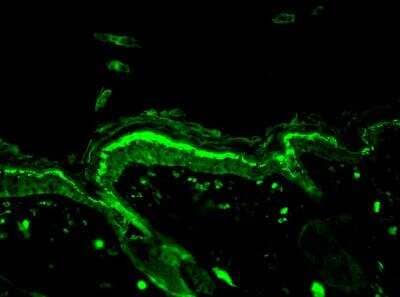 DNA/RNA Damage Antibody (15A3) [NB110-96878] - Immunohistochemistry analysis using Mouse Anti-DNA/RNA DamageMonoclonal Antibody, Clone 15A3 (NB110-96878). Tissue: backskin. Species: Mouse. Fixation: Bouin's Fixative and paraffin-embedded. Primary Antibody: Mouse Anti-DNA/RNA DamageMonoclonal Antibody (NB110-96878) at 1:100 for 1 hour at RT. Secondary Antibody: FITC Goat Anti-Mouse (green) at 1:50 for 1 hour at RT.