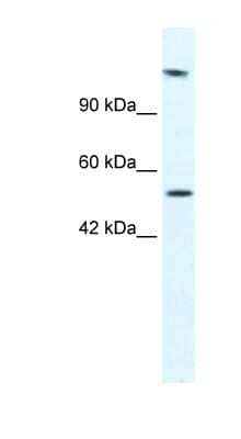 Western Blot: DNA helicase B Antibody [NBP1-57267] - Jurkat cell lysate, concentration 2.5 ug/ml.