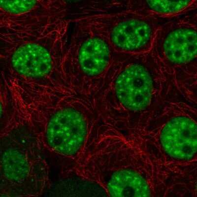 Immunocytochemistry/Immunofluorescence: DNA helicase HEL308 Antibody [NBP2-58095] - Staining of human cell line MCF7 shows localization to nucleoplasm & nuclear speckles.