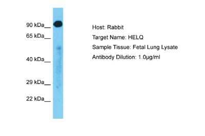 Western Blot: DNA helicase HEL308 Antibody [NBP2-84796] - Host: Rabbit. Target Name: HELQ. Sample Type: Fetal Lung lysates. Antibody Dilution: 1.0ug/ml