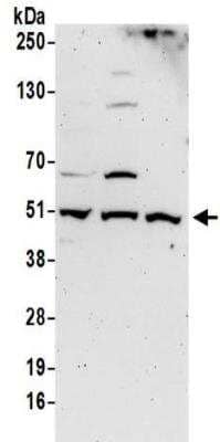 <b>Biological Strategies Validation. </b>Western Blot: DNA polymerase delta p50 Antibody [NBP2-32093] - Whole cell lysate (50 ug) from HeLa, 293T, and Jurkat cells.  Antibodies:  Affinity purified rabbit anti-PolD2 antibody NBP2-32093 used for WB at 0.4 ug/ml.  Detection: Chemiluminescence with an exposure time of 3 minutes.