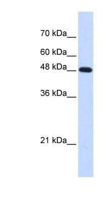 Western Blot: DNA polymerase mu Antibody [NBP1-58202] - Titration: 0.2-1 ug/ml, Positive Control: Transfected 293T.