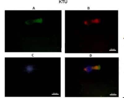 Immunohistochemistry: DNAAF2 Antibody [NBP1-70428] - Human nasal epithelial cells Primary antibody dilution: 1:500 Secondary antibody: Goat anti-rabbit Alexa Fluor 546  Secondary antibody dilution:1:1000