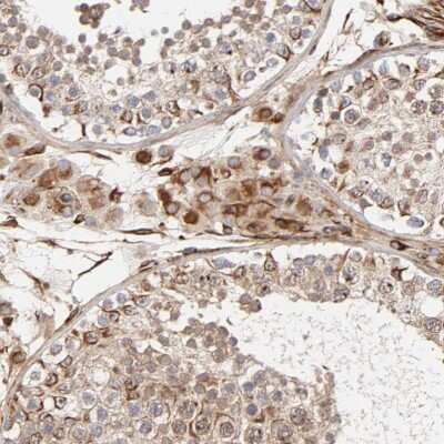 Immunohistochemistry-Paraffin DNAAF2 Antibody - BSA Free