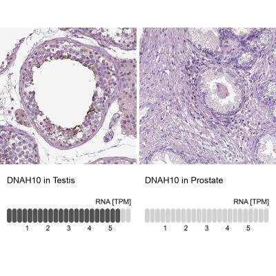 Immunohistochemistry: DNAH10 Antibody [NBP1-81898] - Immunohistochemistry analysis in human testis and prostate tissues. Corresponding RNA-seq data are presented for the same tissues.