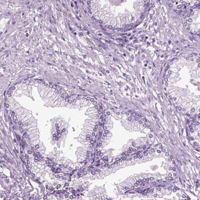 Immunohistochemistry-Paraffin DNAH10 Antibody - BSA Free