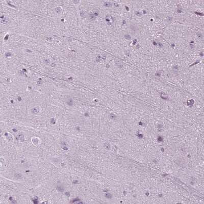 Immunohistochemistry-Paraffin: DNAH10 Antibody [NBP1-81898] - Staining of human cerebral cortex shows no positivity in neurons as expected.