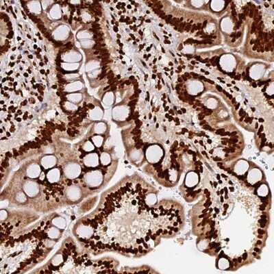 Immunohistochemistry-Paraffin DNAH10OS Antibody - BSA Free