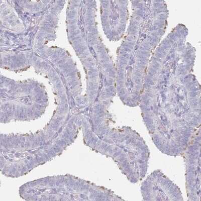 Immunohistochemistry-Paraffin: DNAH11 Antibody [NBP1-91843] - Staining of human fallopian tube shows moderate positivity in cilia in glandular cells.