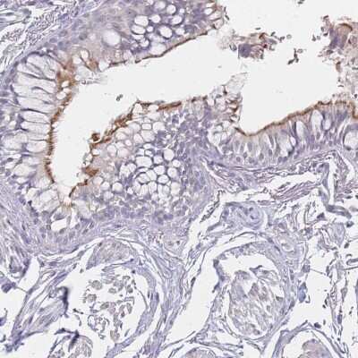 Immunohistochemistry-Paraffin: DNAH11 Antibody [NBP1-91843] - Staining of human bronchus shows moderate positivity in cilia in respiratory epithelial cells.