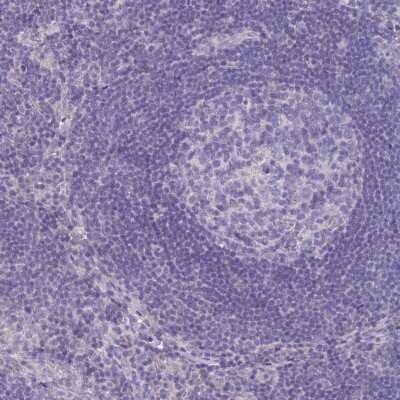 Immunohistochemistry-Paraffin DNAH11 Antibody