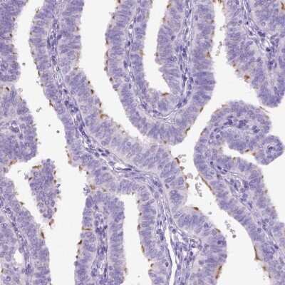 Immunohistochemistry-Paraffin DNAH11 Antibody