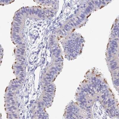 Immunohistochemistry: DNAH14 Antibody [NBP2-38182] - Staining of human fallopian tube shows moderate positivity in cilia.