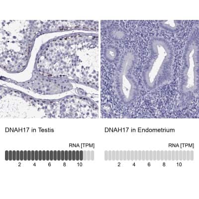 Immunohistochemistry-Paraffin: DNAH17 Antibody [NBP2-62702] - Analysis in human testis and endometrium tissues using Anti-DNAH17 antibody. Corresponding DNAH17 RNA-seq data are presented for the same tissues.