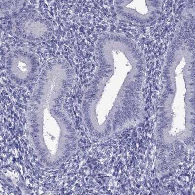 Immunohistochemistry-Paraffin: DNAH17 Antibody [NBP2-62702] - Staining of human endometrium shows low expression as expected.