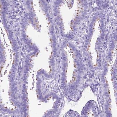 Immunohistochemistry-Paraffin: DNAH2 Antibody [NBP2-49506] - Staining of human fallopian tube shows high expression.