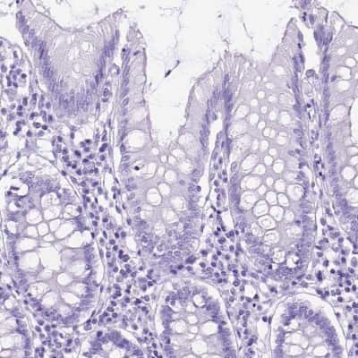 Immunohistochemistry-Paraffin: DNAH2 Antibody [NBP2-49506] - Staining of human colon shows low expression as expected.