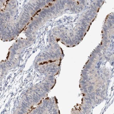 Immunohistochemistry-Paraffin: DNAH5 Antibody [NBP1-84464] - Staining of human fallopian tube shows high expression.