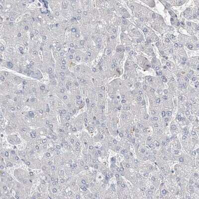 Immunohistochemistry-Paraffin: DNAH5 Antibody [NBP1-84464] - Staining of human liver shows low expression as expected.