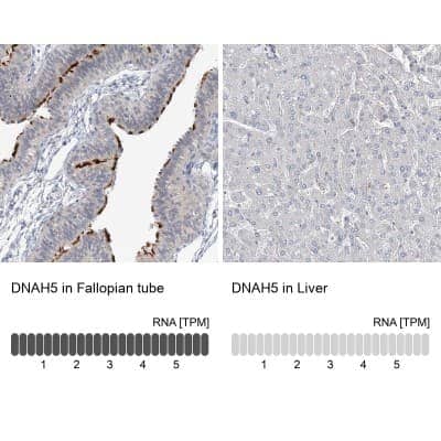 <b>Orthogonal Strategies Validation. </b>Immunohistochemistry-Paraffin: DNAH5 Antibody [NBP1-84464] - Staining in human fallopian tube and liver tissues using anti-DNAH5 antibody. Corresponding DNAH5 RNA-seq data are presented for the same tissues.