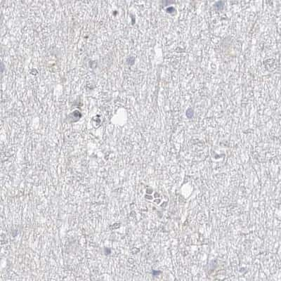 Immunohistochemistry-Paraffin: DNAH5 Antibody [NBP1-84464] - Staining of human cerebral cortex.