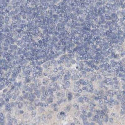 Immunohistochemistry-Paraffin: DNAH5 Antibody [NBP1-84464] - Staining of human lymph node.